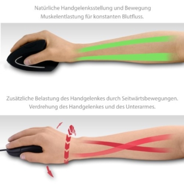 ergoniomische maus csl gegen mausarm